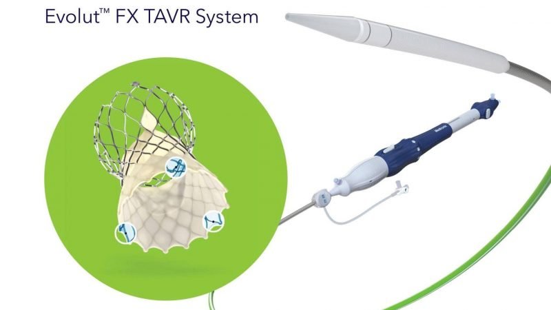 BỆNH VIỆN FV TIÊN PHONG ỨNG DỤNG CÔNG NGHỆ THAY VAN ĐỘNG MẠCH CHỦ THẾ HỆ MỚI NHẤT